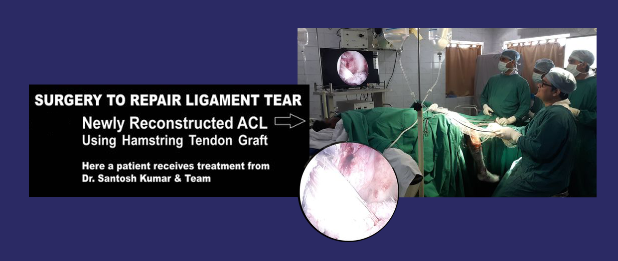 Dr. Santosh Kumar, Best Orthopedic Surgeon in Kolkata